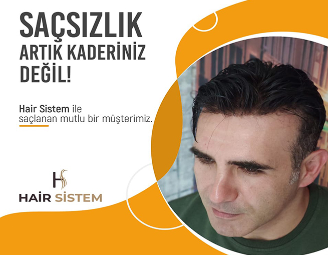 https://hairsistem.com/wp-content/uploads/2024/09/hairsistem-hak-2.jpg